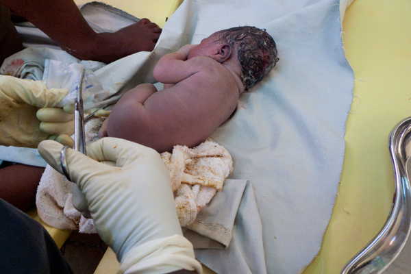 [RELEASE OBTAINED] A midwife cuts the umbilical cord of Christopher, who has just been born at the Chelstone Clinic. His mother, Maureen Sakala, lives with her mother, siblings and twelve orphaned children, including the children of her brother who died of AIDS. Ms. Sakala, who is unemployed and unmarried, learned that she was HIV-positive during an antenatal check-up. She participates in the PMTCT programme at the clinic. At six weeks old, Christopher will be tested for HIV. [#3 IN SEQUENCE OF TWELVE]



In April 2009 in Lusaka, the capital of Zambia, the Chelstone Clinic provides vital programmes to treat HIV-positive pregnant women and prevent mother-to-child transmission of HIV (PMTCT). PMTCT programmes include HIV testing during pregnancy, antiretroviral (ARV) regimens for sick HIV-positive pregnant women, prophylactic antibiotics and ARVs for infants exposed to HIV in utero, and early infant diagnosis and treatment. HIV-positive infants diagnosed and treated within the first 12 weeks of life are 75 per cent less likely to die from the virus. However, many infants do not receive PMTCT services because their caretakers lack access to properly equipped facilities or fear the stigma associated with HIV. Zambia has recently made great strides in expanding PMTCT programmes. In 2007, HIV tests were administered to 65 per cent of pregnant women in the country, and nearly half of HIV-positive pregnant women received ARVs. But, for PMTCT measures to be effective, infants must adhere to a long-term, structured course of tests and services, which is difficult for many caretakers.
